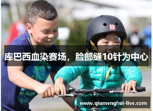 库巴西血染赛场，脸部缝10针为中心